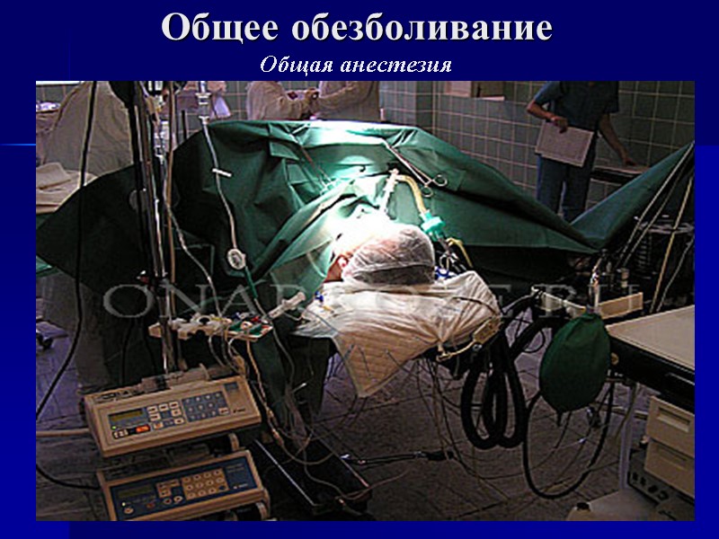 Общее обезболивание Общая анестезия